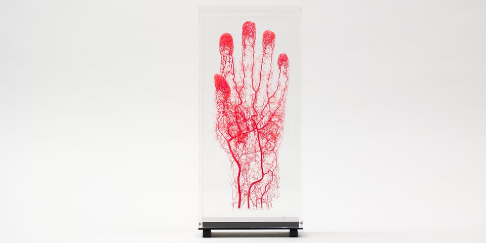 Korrosionspräparat, Gefässe der linken Hand (roter Kunststoff). Präparateur*in: Klaws (Kiel) und Heuckendorf (Berlin), Datierung: 2003. Sammlung: Sammlung am Centrum für Anatomie. Foto: Felix Sattler/HU Berlin
